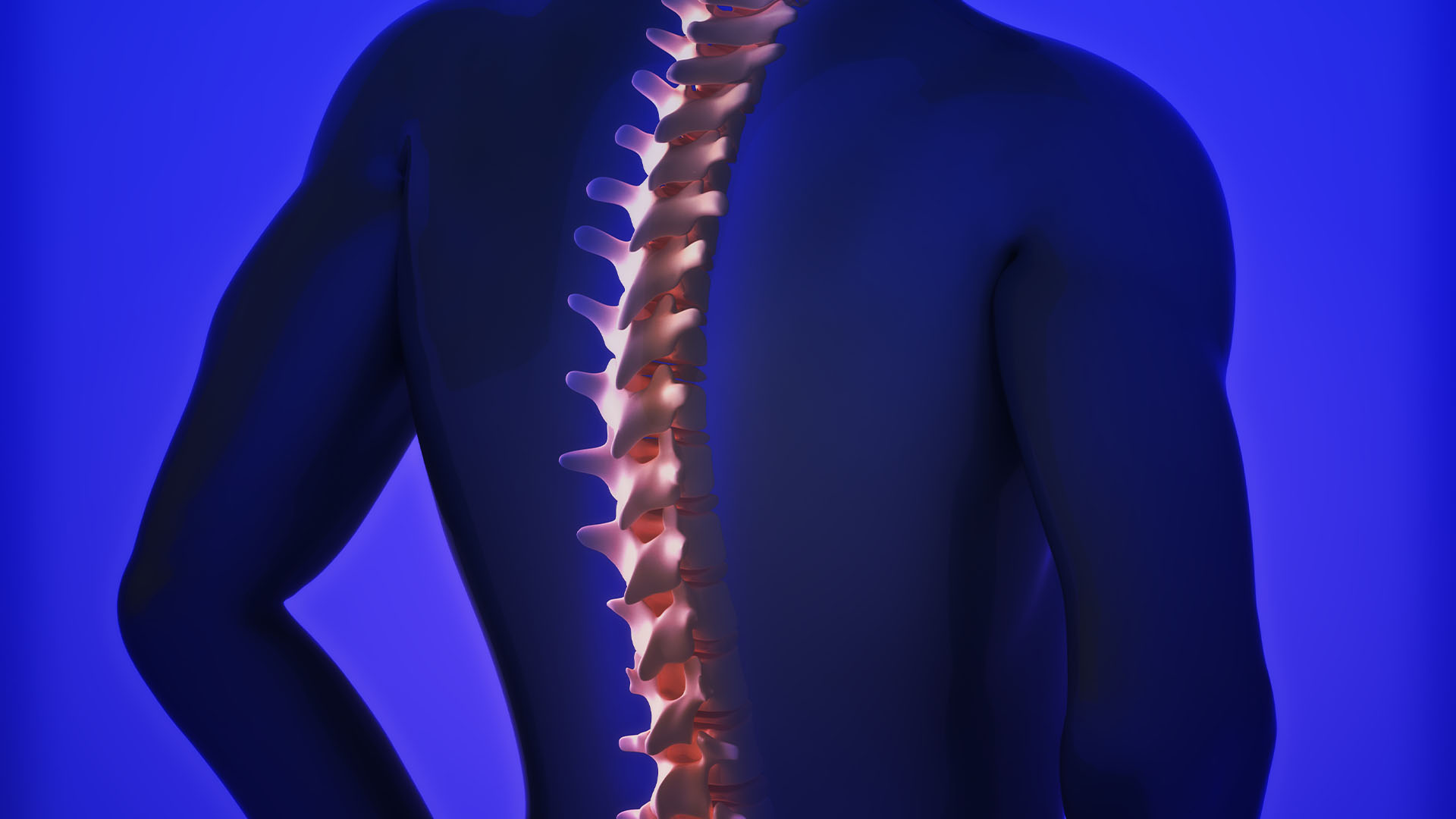espresonancia magnetica lumbar