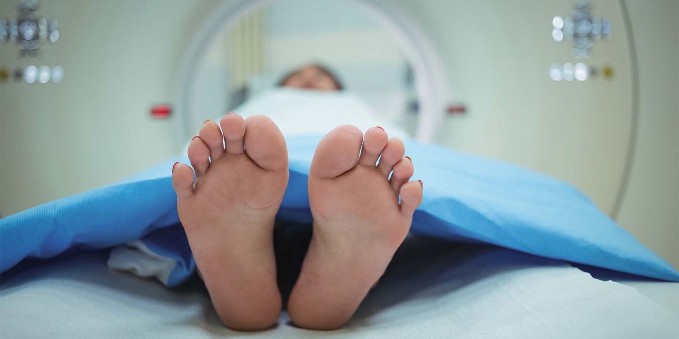 Ankle MRI