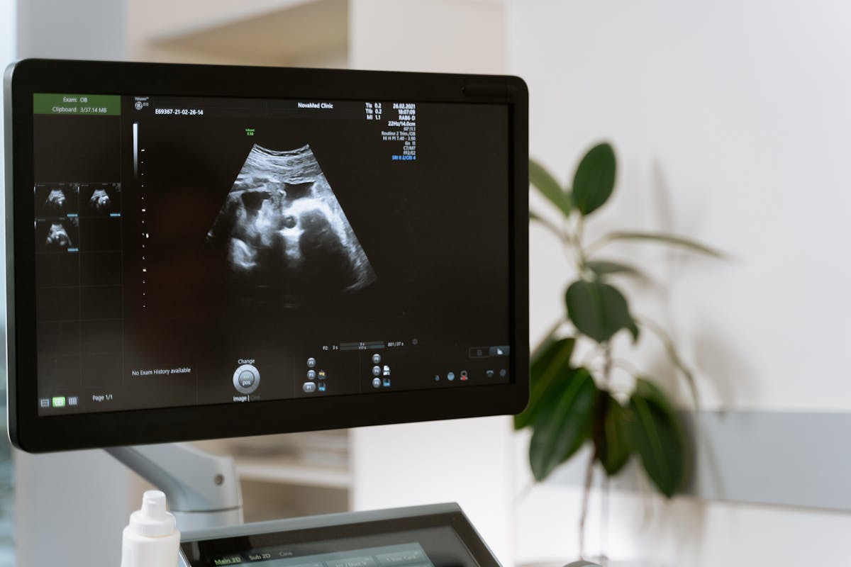 Ultrasonido obstétrico mostrando imagen fetal en monitor clínico